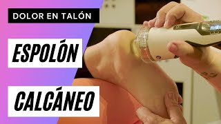 ESPOLÓN Calcáneo 🆘 DOLOR en el Talón 😖Causas y TRATAMIENTO [upl. by Dorison]