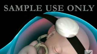 7 WEEKS FETAL DOPPLER BABYS HEARTBEAT [upl. by Ahseekal]