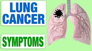 Lung Cancer  All Symptoms [upl. by Onoitna]