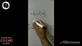 Retinoscopy 3  calculation [upl. by Dahsar]