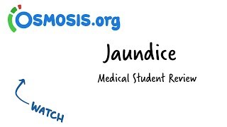 Jaundice  Clinical Presentation [upl. by Alenas]