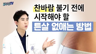 가장 쉬운 다이어트 튼살 없애기 방법 레이저 크림 피부과전문의 피부심 [upl. by Tepper]