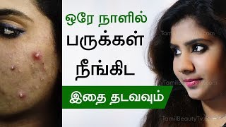 How to remove pimple  Home remedies for pimples  Beauty Tips in Tamil [upl. by Aelaza]