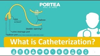 Cardiac Catheterization for Angioplasty [upl. by Herwick]