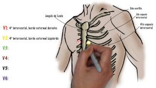 Como hacer un ECG electrocardiograma [upl. by Storz]