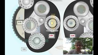 Retinoscopy with Refracting Instrument Minus cylinder [upl. by Toback]