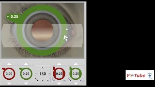 Retinoscopy Basics  Dr Zain Khatib [upl. by Stafani]