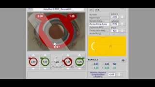 Retinoscopy Simulator Tutorial  Retinoscopy part 2 [upl. by Hudgens]