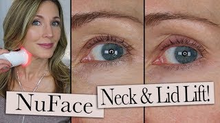 NuFace Trinity ELE  Wrinkle Reducer Review  Eyelid Lift  Neck Wrinkles [upl. by Tegirb]