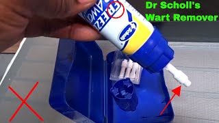 ✅ How To Use Dr Scholls Freeze Away Wart Remover Review [upl. by Flessel]