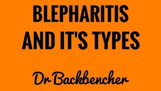 Blepharitis  Types causes clinical features and treatment  Ophthalmology [upl. by Anelrad]