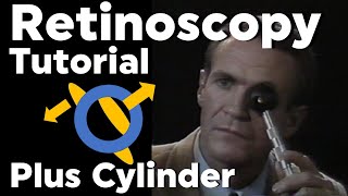 Retinoscopy Plus Cylinder Full Tutorial with Phoropter [upl. by Halyk]