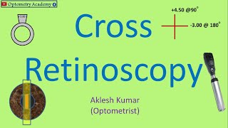 Cross Retinoscopy  Retinoscopy Procedure [upl. by Tteltrab]