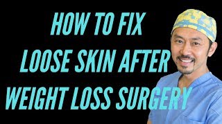 quotLoose Skin After Weight Loss SurgeryquotReal Talk With Dr V [upl. by Mylander138]