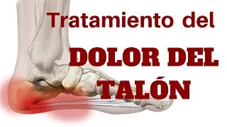 TRATAMIENTO DEL DOLOR DEL TALÓN [upl. by Fraze]