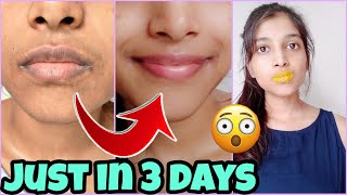 How I get rid of Pigmented lips 👄 REAL LIP CARE ROUTINE changes my lip colour [upl. by Attennaj]