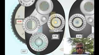 Retinoscopy with Refracting Instrument Plus cylinder [upl. by Yrelbmik]