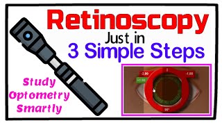 Retinoscopy in 3 Simple Steps [upl. by Eyanaj]