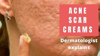 Acne Scar Creams  Dermatologist Reviews [upl. by Pernas]