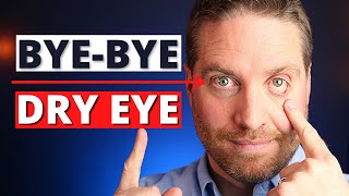 How To Get Rid Of Dry Eyes  4 Advanced Home Treatments [upl. by Guy88]