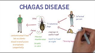 Chagas Disease  An overview [upl. by Maon]