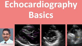 Echocardiography Basics [upl. by Pope254]