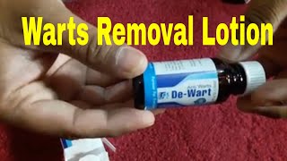 Wart Removal Lotion [upl. by Jarrad]