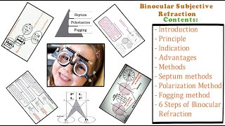 Binocular Subjective Refraction  Full Tutorial [upl. by Anawd]