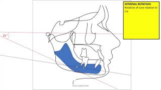 mandibular rotation [upl. by Bendicta381]