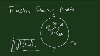 Doppler Fetal MCA [upl. by Pharaoh]