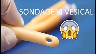 Sondagem Vesical  Aula rápida [upl. by Hoeve500]