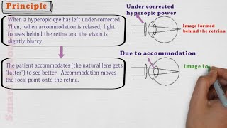 Fogging Method  Binocular Subjective refraction 44 [upl. by Ardnek]