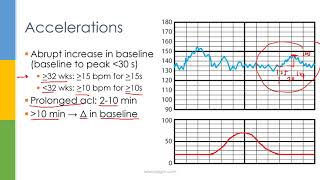 HOW TO USE AN AT HOME FETAL DOPPLER  FINDING BABYS HEART BEAT  TRYING BABY DOPPLER SONOLINE B [upl. by Notlaw970]