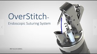 OverStitch™ Endoscopic Suturing System [upl. by Penny179]