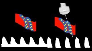 Fetal Measurements Tips and Tricks [upl. by Telfore]