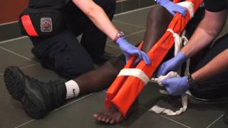 EMT Training  Leg Splinting [upl. by Retsek897]