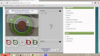 Retinoscopy Simulator Tutorial SPHCYL Method [upl. by Salina]