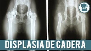 Displasia De Cadera En Perros  Prevención Síntomas y Tratamiento [upl. by Vandyke]